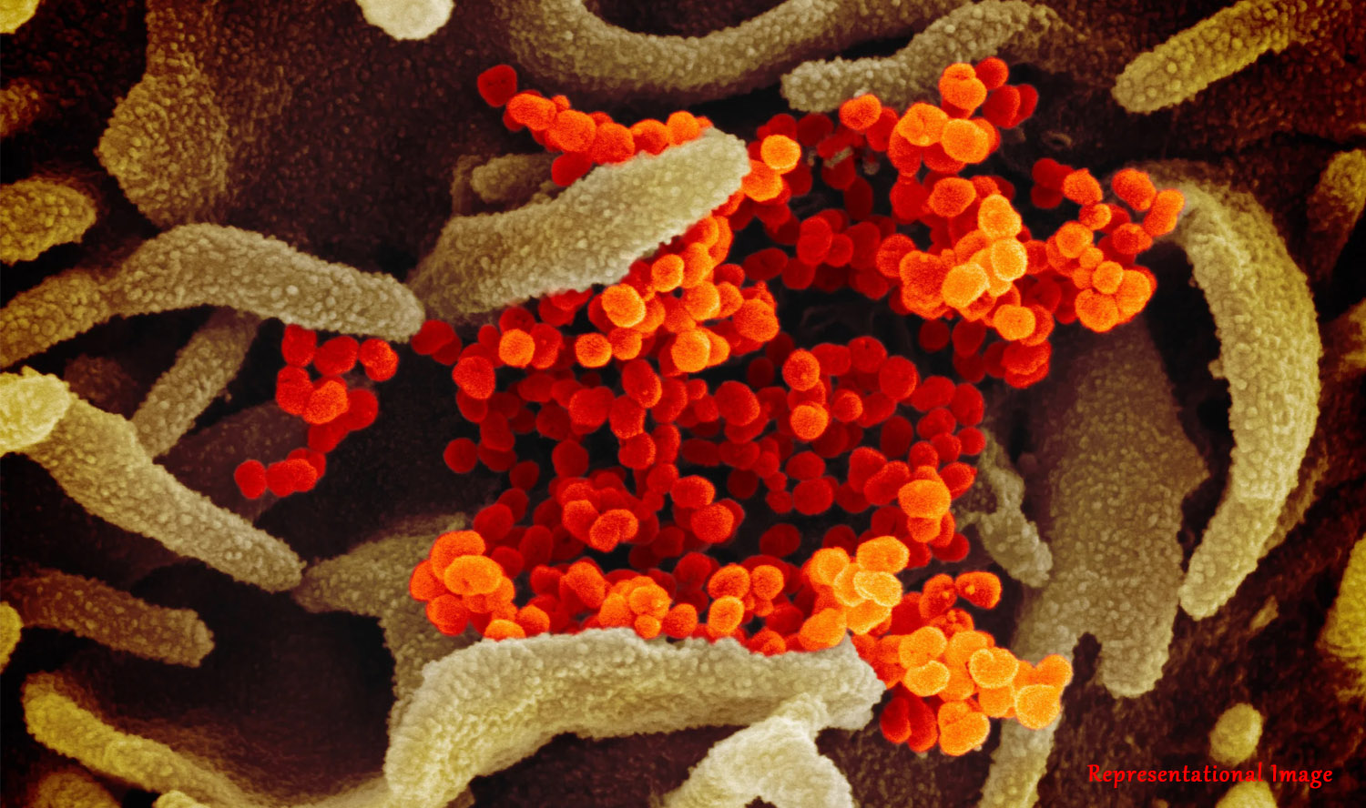 A multi-purpose coronavirus antibody database